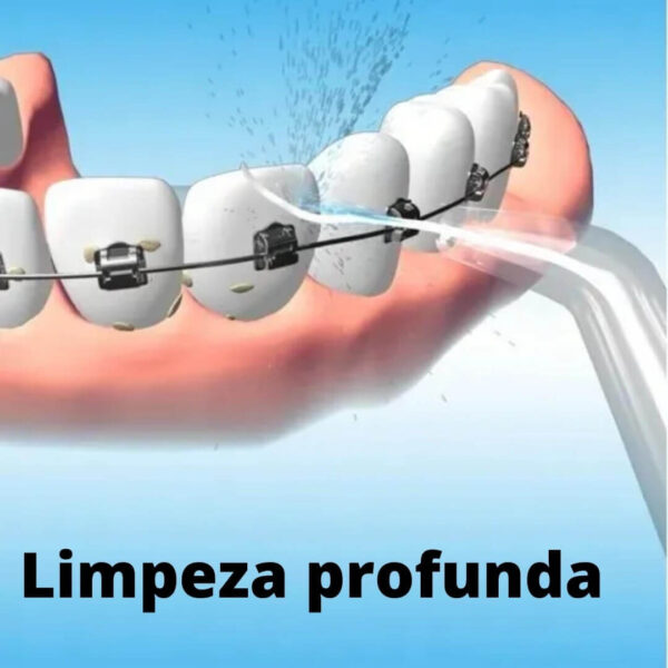 Waterpik Jato D Água Limpador Irrigador Bucal Dentes Gengiva - Imagem 3